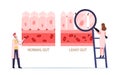 Comparison of Normal and Sick Gastrointestinal Tract Tissue, Leaky Gut Syndrome. Healthy and Inflamed Intestinal Cells