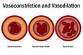 Comparison of normal, vasoconstriction and vasodilation blood vessels with cross section of arteries