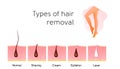 Comparison of the popular methods of hair removal: