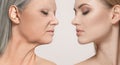 Comparison. Portrait of beautiful woman with problem and clean skin, aging and youth concept, beauty treatment Royalty Free Stock Photo