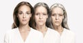 Comparison. Portrait of beautiful woman with problem and clean skin, aging and youth concept Royalty Free Stock Photo