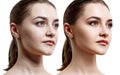 Comparison portrait of young woman before and after retouch.