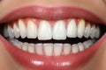 before and after comparison of teeth color on a dental shade guide Royalty Free Stock Photo