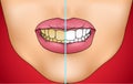 Comparison of unhealthy teeth with white clean healthy teeth Royalty Free Stock Photo