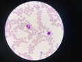 Comparison white blood cell Eosinophil and Lytmphocyte