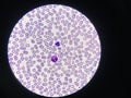 Comparison white blood cell Eosinophil and Neutrophil