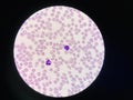 Comparison white blood cell Neutrophil and Lytmphocyte