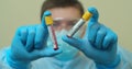 Competent medical worker in protective uniform holding test tube with blood for analysis on COVID 19 virus. Concept of