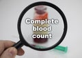 Complete blood count. A blood sample for a test. The doctorÃ¢â¬â¢s hand holds a magnifying glass in which a test tube with a blood
