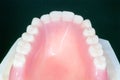 Complete denture or full denture.