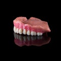 Complete maxillary denture Ã¢â¬â Wax-Up and Gingival Contouring Royalty Free Stock Photo