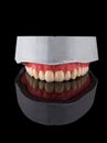 Complete maxillary denture Ã¢â¬â Wax-Up and Gingival Contouring Royalty Free Stock Photo