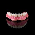 Complete maxillary denture Ã¢â¬â Wax-Up and Gingival Contouring Royalty Free Stock Photo