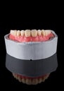 Complete maxillary denture Ã¢â¬â Wax-Up and Gingival Contouring Royalty Free Stock Photo