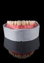 Complete maxillary denture Ã¢â¬â Wax-Up and Gingival Contouring