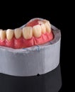 Complete maxillary denture Ã¢â¬â Wax-Up and Gingival Contouring Royalty Free Stock Photo