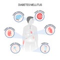 Complications of diabetes mellitus Royalty Free Stock Photo