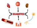 Complications of diabetes mellitus Royalty Free Stock Photo