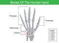 Components description of human hand bone