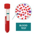 Composition of blood in tume and microscope. Vector image. Royalty Free Stock Photo