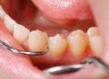 Comprehensive dental examination