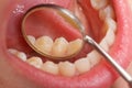 Comprehensive dental examination Royalty Free Stock Photo