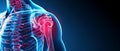 Comprehensive guide on shoulder pain symptoms, causes, and treatments. Royalty Free Stock Photo