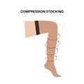 Compression stocking pressure