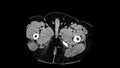 Computed medical tomography MRI upscaled scan of human illness