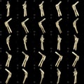 Computed tomogram of bone fracture