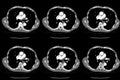 Computed tomography CT whole abdomen in Axial. Part two