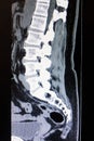 Computed tomography image of the cervical spine Royalty Free Stock Photo