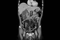 Computer tomography scan technology in surgical patient with abdominal pain.