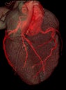 CT coronary angiography rendering