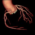 CT coronary angiography rendering