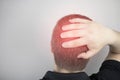 A man suffers from pain in the back of his head. Signs of cervical osteochondrosis, spondylosis, myositis, or hypertension. The