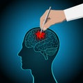 The concept of brain recovery, memory, stroke, treatment of brain