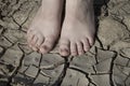 Woman`s legs are standing on cracked earth. The concept of dry skin of the feet and lack of moisture, fungal diseases