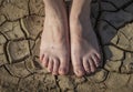 Woman`s legs are standing on cracked earth. The concept of dry skin of the feet and lack of moisture, fungal diseases