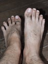 Concept of foot drop. Left foot is blurred. Foot drop is a gait abnormality Royalty Free Stock Photo