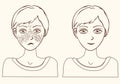 Concept for girl remove freckles outline.