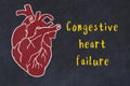 Chalk sketch of human heart on black desc and inscription Congestive heart failure