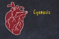 Concept of learning cardiovascular system. Chalk drawing of human heart and inscription Cyanosis