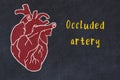 Concept of learning cardiovascular system. Chalk drawing of human heart and inscription Occluded artery Royalty Free Stock Photo