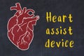 Concept of learning cardiovascular system. Chalk drawing of human heart and inscription Heart assist device