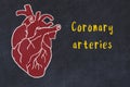 Concept of learning cardiovascular system. Chalk drawing of human heart and inscription Coronary arteries Royalty Free Stock Photo