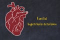 Concept of learning cardiovascular system. Chalk drawing of human heart and inscription Familial hypercholesterolemia