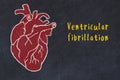 Concept of learning cardiovascular system. Chalk drawing of human heart and inscription Ventricular fibrillation Royalty Free Stock Photo