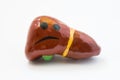 Concept photo of unhappy, sad liver with sickness disorder. Model of liver gallbladder with sad smile, which symbolizes hepatobil