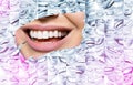 Conceptual background makes of set of laughing human faces with great teeth and detail of young woman`s beautiful smile . Healthy